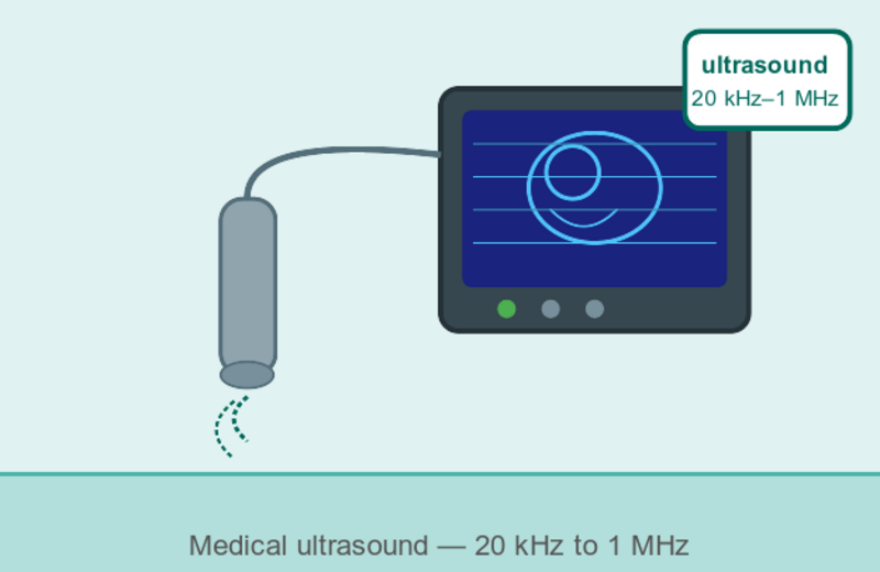 Illustration of an ultrasound wave